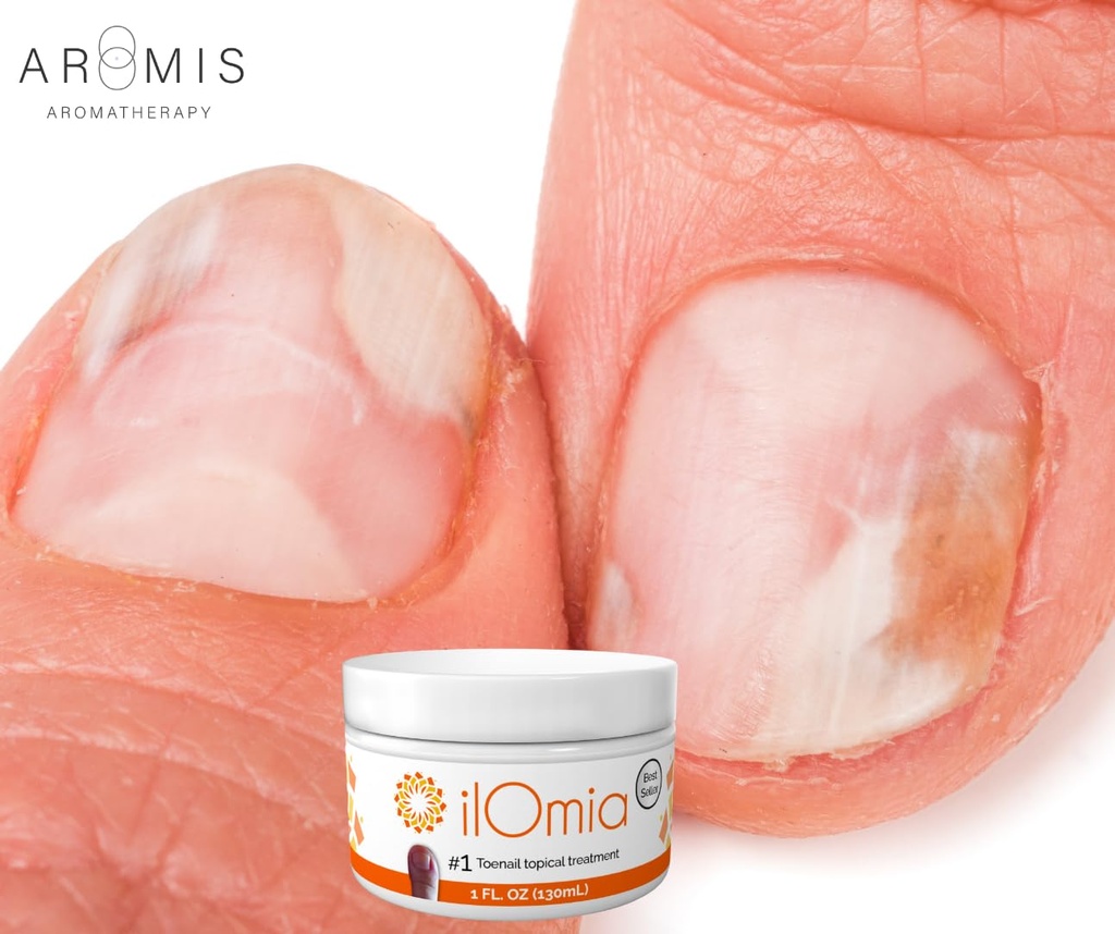 natural-toenail-fungi-cream-for-dam-age--6.jpg