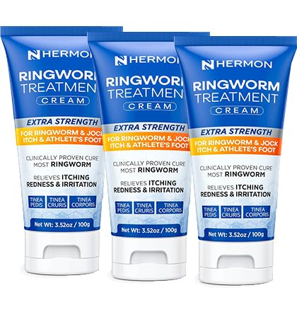 Hermon Antifungal Ringworm Cream for Humans - Helps Relieve Itching, Redness & Discomfort from Ringworm, Jock Itch, Athlete’s Foot & Tinea Versicolor - Gentle for Adults & Kids 3Pack