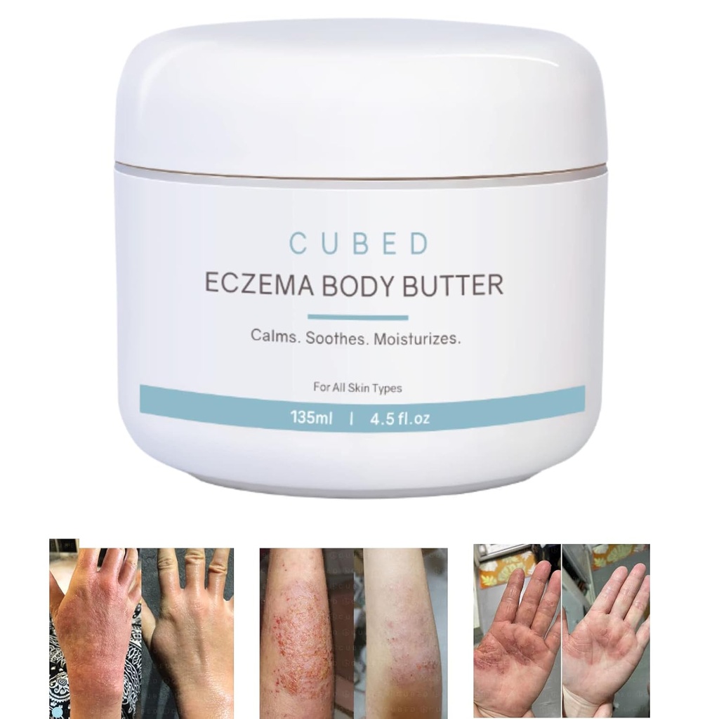 Cubed 4.5 oz Eczema Cream för vuxna, Eczema Relief, Eczema Behandling, Moisturize Dry Irridated Skin, Smart Lotion för aktuell steroid Uttag Symptom, Psoriasis & Rosacea, Eczema, Dermatit
