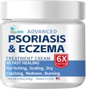 Bio-MD Psoriasis Ekseema Cream, Ekseema Cream aikuisille, Extra Strength Control Reccurrence, Relieve Symptom of Resistant, Tehokas Seborrheinc dermatiitti, Follikuliitti Hoito