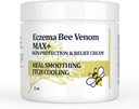 High Strength Bee Venom Cream, Dyshidrotic Eczema Ointment, Heat Rash, Itching, Eczema, Psoriasis, Leg, Stomach, Foot, Hand, Irriterad hud, All Age Care