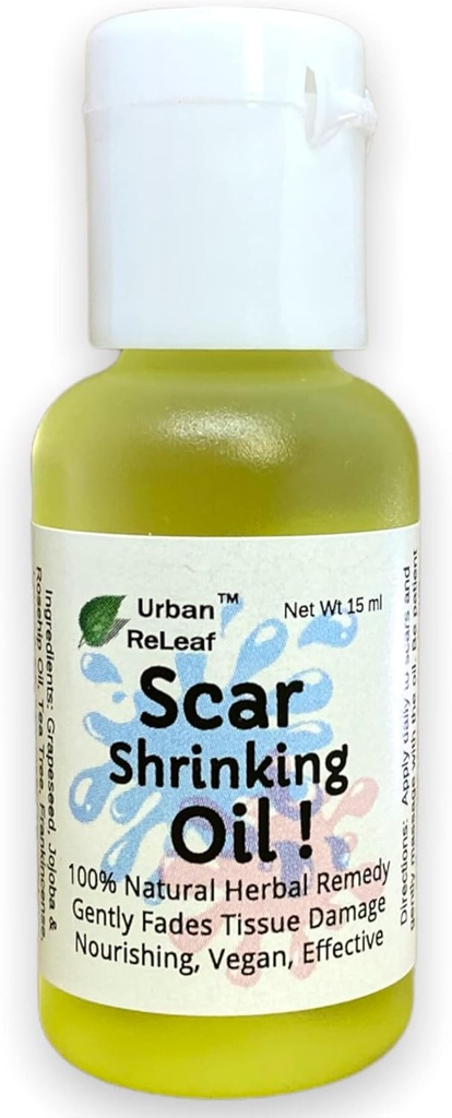 Urban Releaf Arpi Kutistuminen öljy ! Hellävaraisesti Fades Kudosvaurioita, ravitseva Vegan Tehokas. Se auttaa keloideja, kuoppia ja arpia. 100% Natural Remedy.