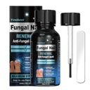 Toenail Fungus Treatment, Nail Fungus Treatment for Toenail, Nail Repair Solution, Fingernails Renewal Liquid for Damaged & Discoloration Nail, Nail Fungus Treatment, Safely and Gently - 30ML (1 FLOZ)