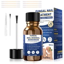Varpaankynsien Sieni hoito,Foot Sieni hoito Extra vahvuus,Fungus kynsien hoito, Varpaankynsien sienien sienien keltainen varpaankynsien hoito [1fl oz/30ml)