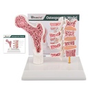 Ultrasti Human Anatomy Osteoporoosi Model, Vertebrae Anatomical Skeleton Model with Study Card for Medical Student Teaching Demonstration