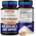 Kasvattaa vitamiini Multi Collagen Kapselit - Tyypit I, II, III, V & X Hydrolysoitu Sekoita Biotiini & C-vitamiini hiukset, iho, kynnet 90 kapselia