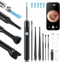 Loyker X6 Korvavaha poistotyökalu Kamera, Korvanpuhdistus Kamera, FSA - HSA Store Oikeutettu, 1080P Korvakamera 6LED Light korvalle/nose / throat / Tonsil kivi tutkimus, musta